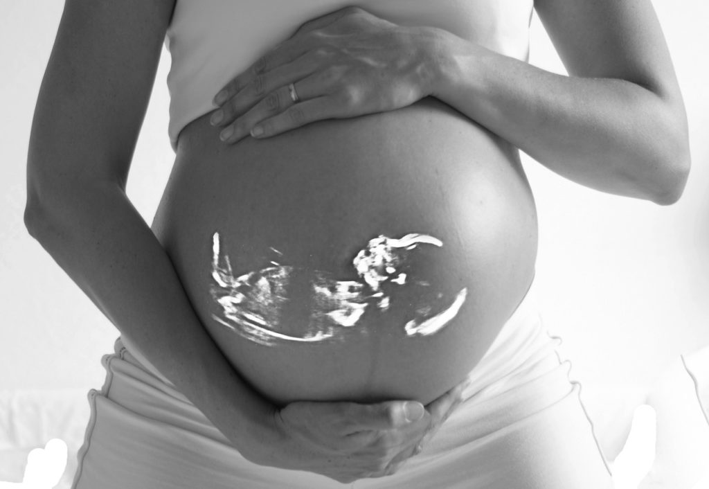 Femme-enceinte-gel-ultrason